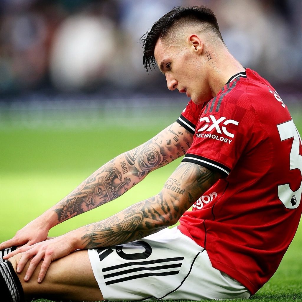 sesko down injured (photo credit: Man United Media)