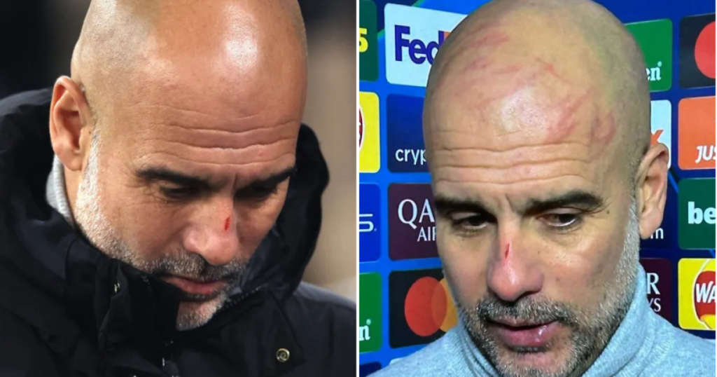 Pep Guardiola’s bizarre self-inflicted injury spotted (Photo Credit: Getty)